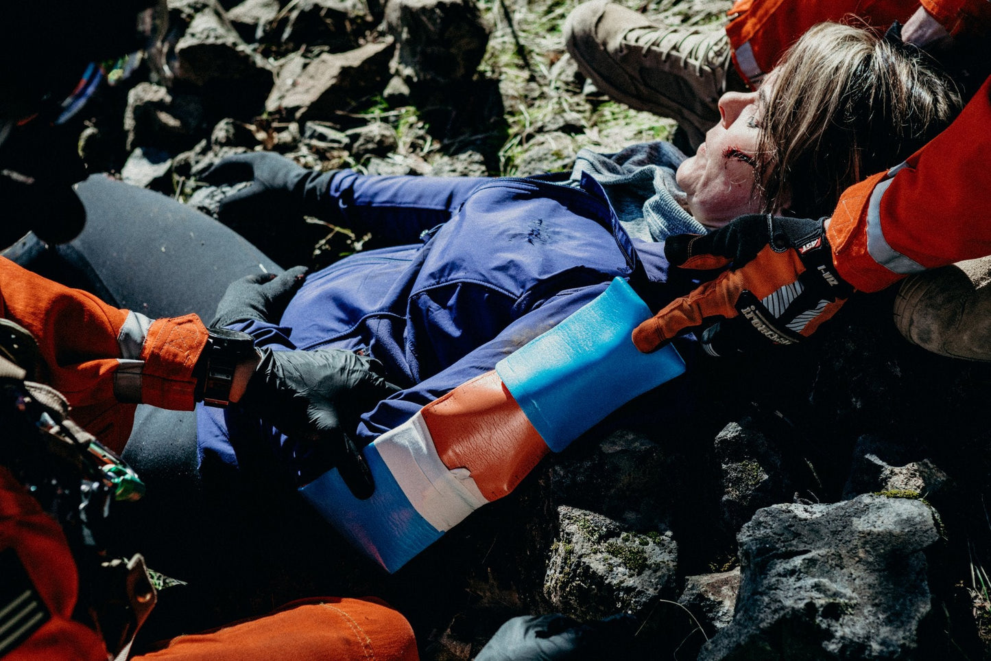SAM SPLINT universalus lankstomas įtvaras 18 colių - oranžinis