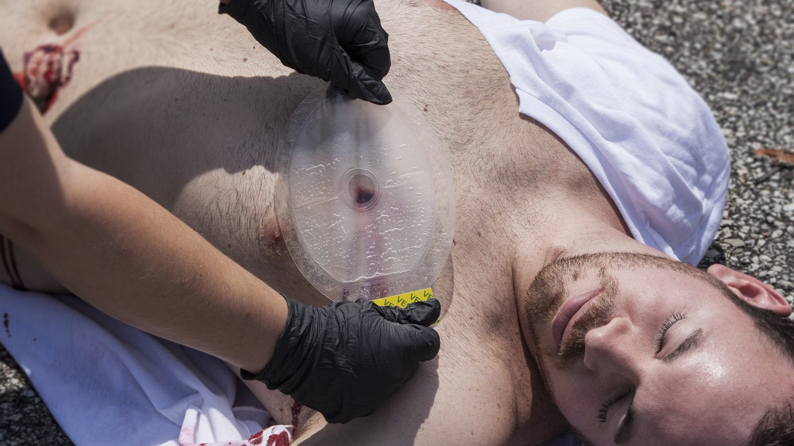 Okliuzinis krūtinės tvarstis "Halo Vent Chest Seal" (2 vnt. rinkinys)